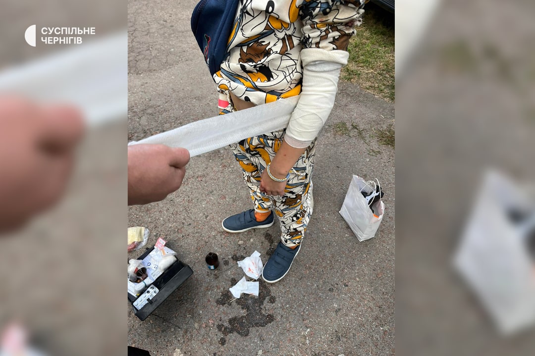 После срабатывания гранатомета пострадал ребенок